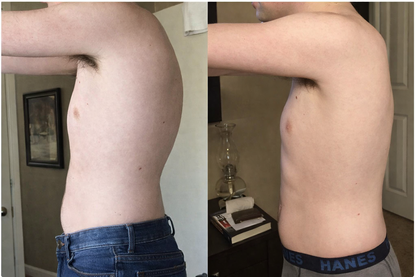 Posturely: Instant Posture Corrector